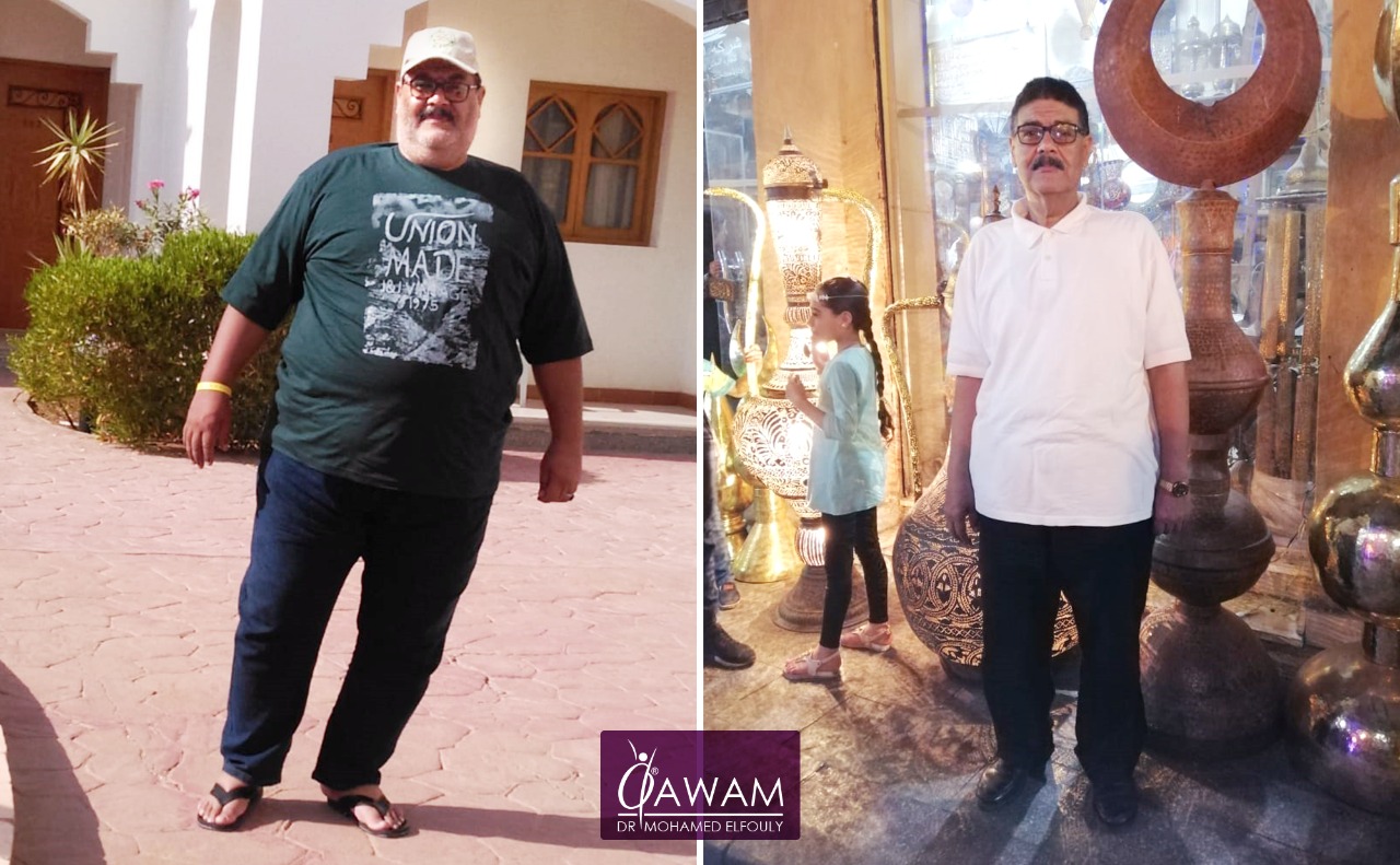 تجارب عملية التكميم استاذ زينهم