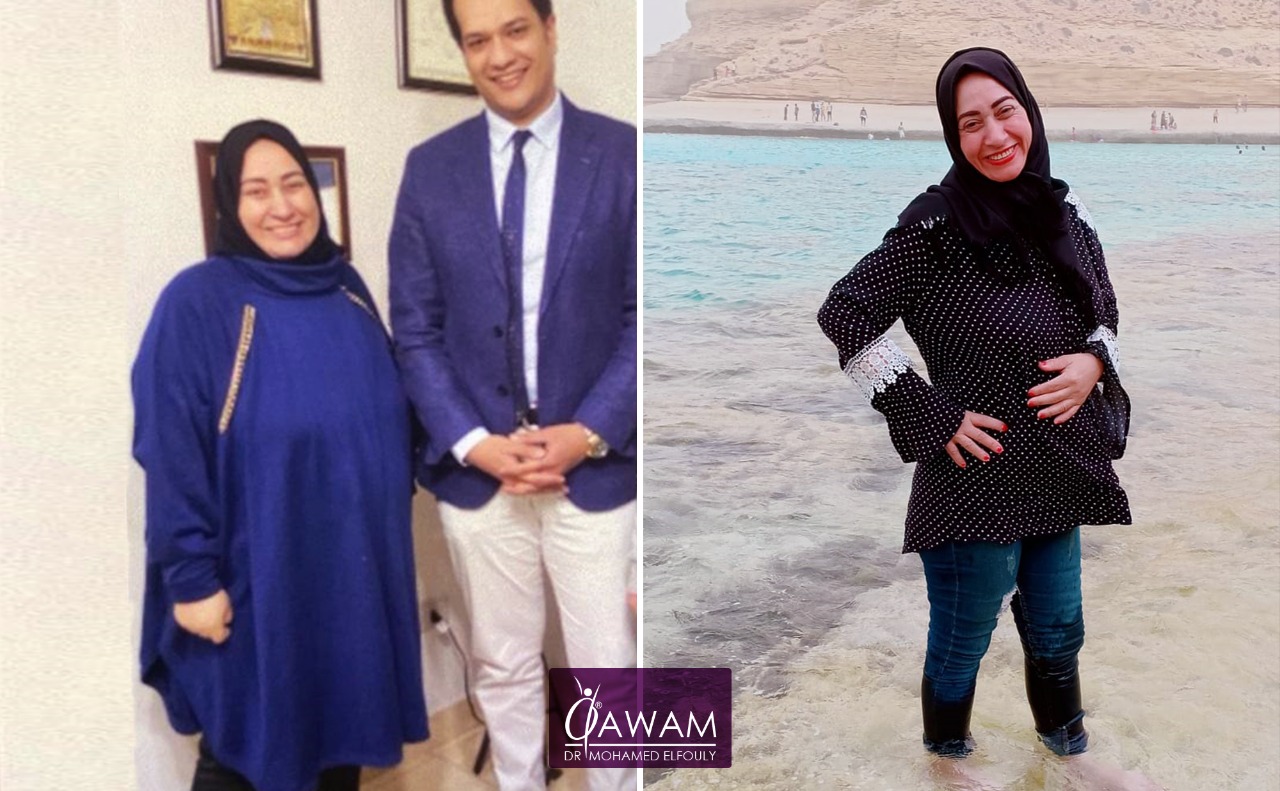 تجربتي مع عملية تحويل المسار