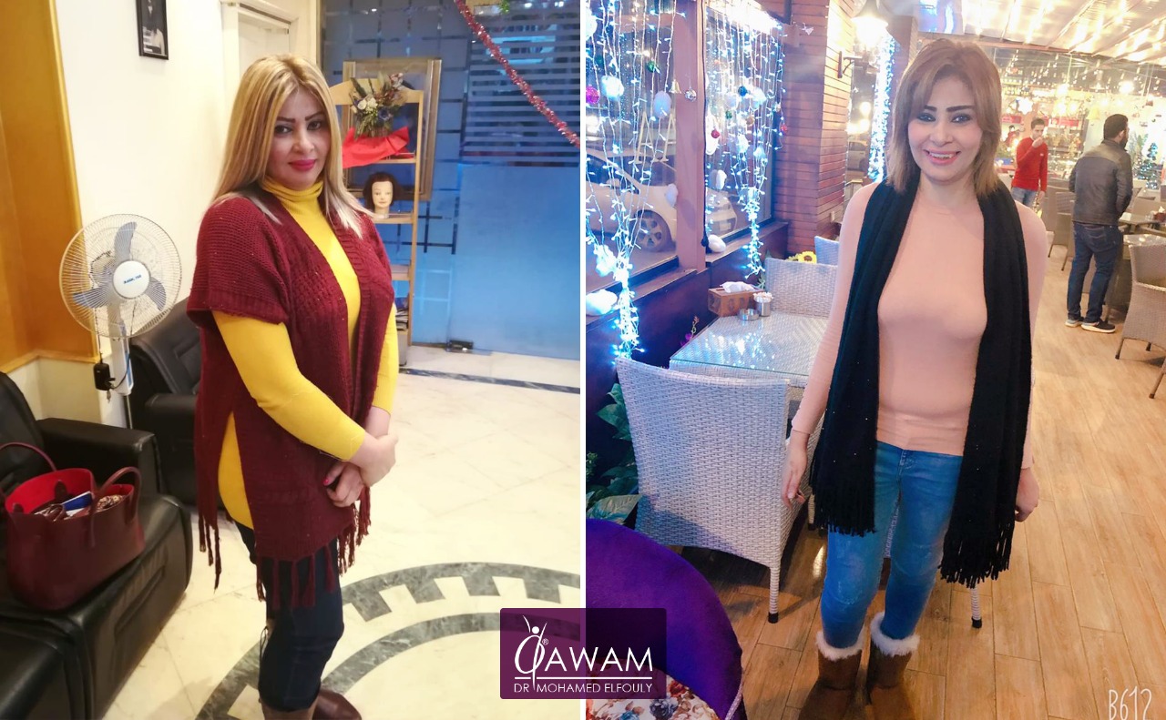 تجارب عملية تحويل المسار