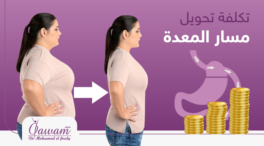 تكلفة عملية تحويل المسار