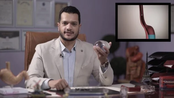 افضل دكتور بالون معدة في مصر